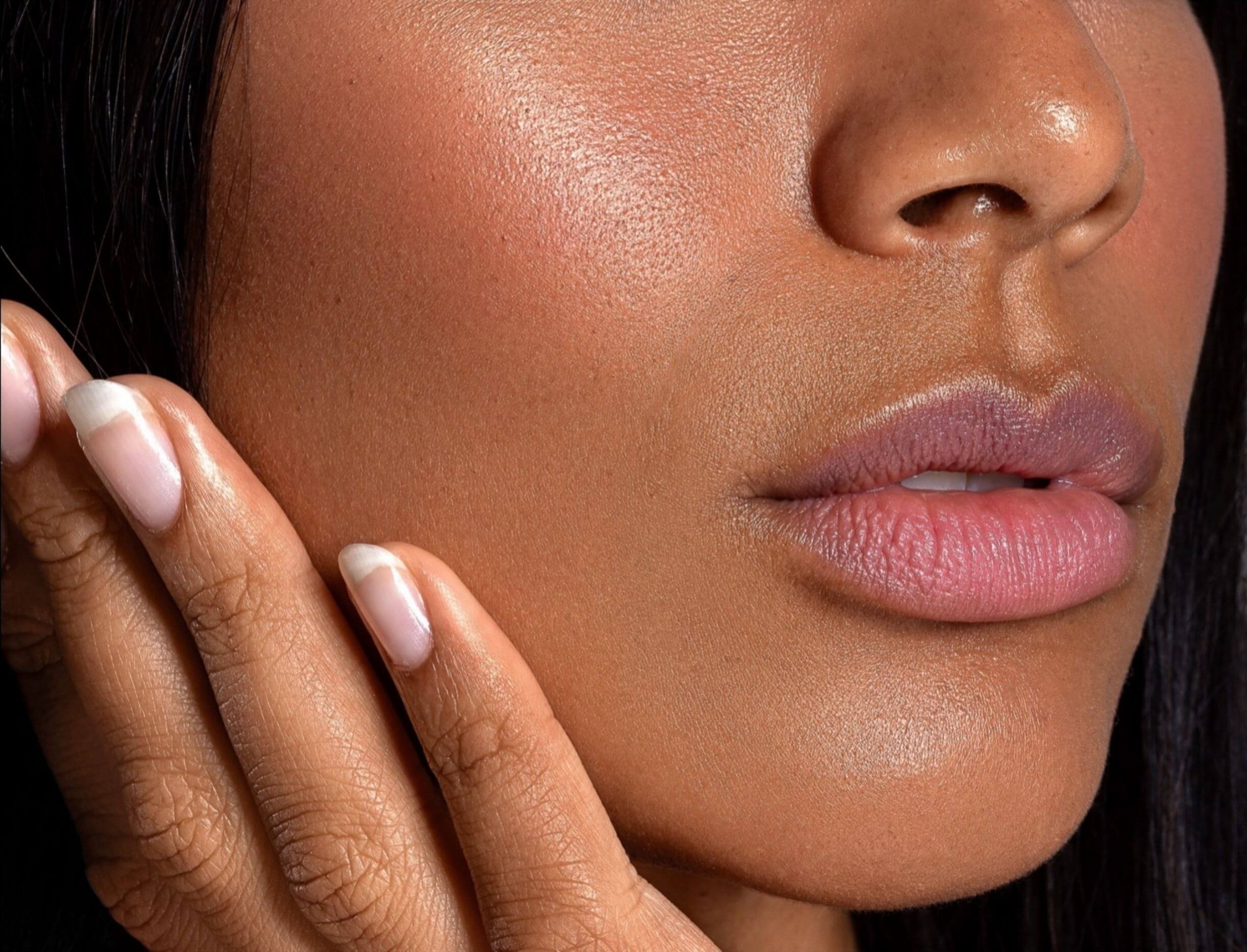 The Truth About Filler Migration: Separating Facts From Social Media Fear Image
