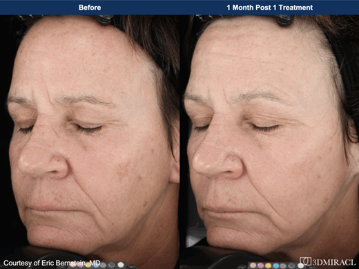 Case#07 Combine Image