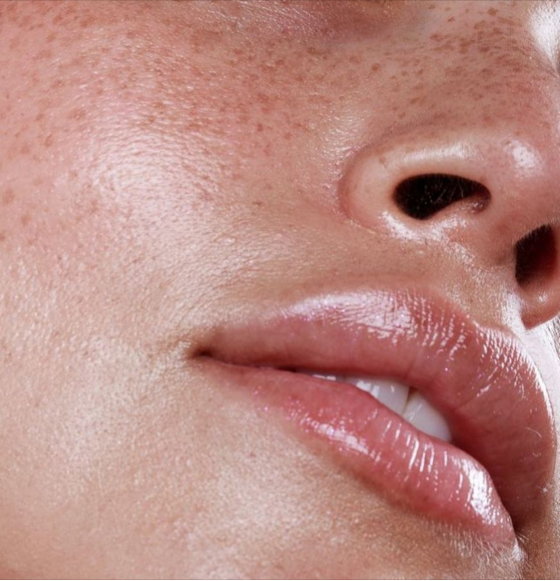 Injectables Image